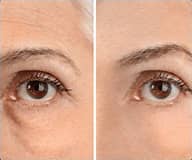 SilkLift – Koreaanse Collageen Peptide