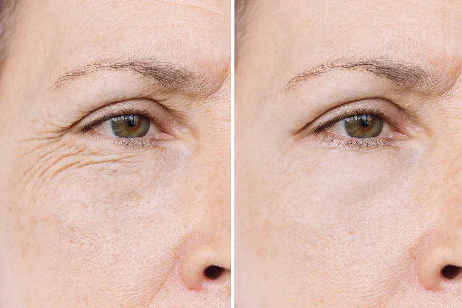 SilkLift – Koreaanse Collageen Peptide